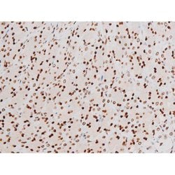 Invitrogen Phospho-NFkB p65 (Thr435) Polyclonal Antibody 100 &mu;L | Buy Online | Invitrogen&trade; | Fisher Scientific