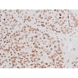 Invitrogen Phospho-NFkB p65 (Thr435) Polyclonal Antibody 100 &mu;L | Buy Online | Invitrogen&trade; | Fisher Scientific