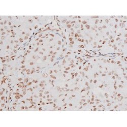 Invitrogen Phospho-NFkB p65 (Thr435) Polyclonal Antibody 100 &mu;L | Buy Online | Invitrogen&trade; | Fisher Scientific