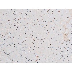 Invitrogen Phospho-NFkB p65 (Thr435) Polyclonal Antibody 100 &mu;L | Buy Online | Invitrogen&trade; | Fisher Scientific