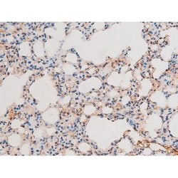 Invitrogen Phospho-NFkB p65 (Thr435) Polyclonal Antibody 100 &mu;L | Buy Online | Invitrogen&trade; | Fisher Scientific