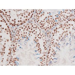 Invitrogen Phospho-NFkB p65 (Thr435) Polyclonal Antibody 100 &mu;L | Buy Online | Invitrogen&trade; | Fisher Scientific