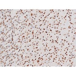 Invitrogen Phospho-NFkB p65 (Thr435) Polyclonal Antibody 100 &mu;L | Buy Online | Invitrogen&trade; | Fisher Scientific