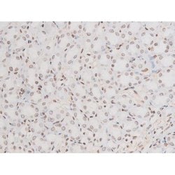 Invitrogen Phospho-NFkB p65 (Thr435) Polyclonal Antibody 100 &mu;L | Buy Online | Invitrogen&trade; | Fisher Scientific