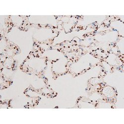 Invitrogen Phospho-NFkB p65 (Thr435) Polyclonal Antibody 100 &mu;L | Buy Online | Invitrogen&trade; | Fisher Scientific