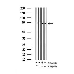 Invitrogen Phospho-NFkB p65 (Thr435) Polyclonal Antibody 100 &mu;L | Buy Online | Invitrogen&trade; | Fisher Scientific