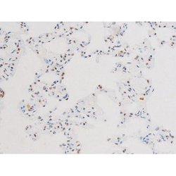 Invitrogen Phospho-NFkB p65 (Ser281) Polyclonal Antibody 100 &mu;L; Unconjugated:Antibodies,