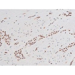 Invitrogen Phospho-NFkB p65 (Ser281) Polyclonal Antibody 100 &mu;L; Unconjugated:Antibodies,