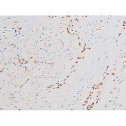 Invitrogen Phospho-NFkB p65 (Ser281) Polyclonal Antibody 100 &mu;L; Unconjugated:Antibodies,