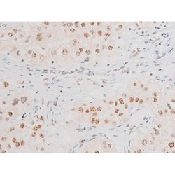 Invitrogen Phospho-NFkB p65 (Ser281) Polyclonal Antibody 100 &mu;L; Unconjugated:Antibodies,