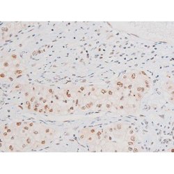 Invitrogen Phospho-NFkB p65 (Ser281) Polyclonal Antibody 100 &mu;L; Unconjugated:Antibodies,