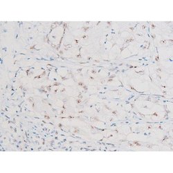 Invitrogen Phospho-NFkB p65 (Ser281) Polyclonal Antibody 100 &mu;L; Unconjugated:Antibodies,