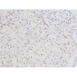 Invitrogen Phospho-NFkB p65 (Ser281) Polyclonal Antibody 100 &mu;L; Unconjugated:Antibodies,