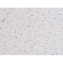 Invitrogen Phospho-NFkB p65 (Ser281) Polyclonal Antibody 100 &mu;L; Unconjugated:Antibodies,