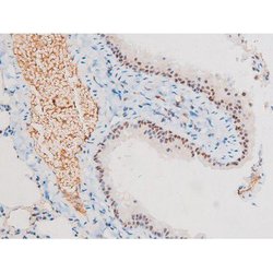 Invitrogen Phospho-NFkB p65 (Ser281) Polyclonal Antibody 100 &mu;L; Unconjugated:Antibodies,