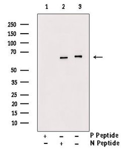 Invitrogen Phospho-NFkB p65 (Ser281) Polyclonal Antibody 100 &mu;L; Unconjugated:Antibodies,