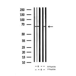 Invitrogen Phospho-NFkB p65 (Ser281) Polyclonal Antibody 100 &mu;L; Unconjugated:Antibodies,