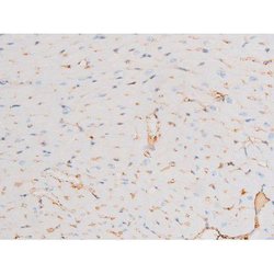 Invitrogen Phospho-Dynamin 1 (Ser774) Polyclonal Antibody 100 &mu;L; Unconjugated:Antibodies,