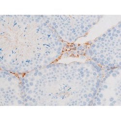 Invitrogen Phospho-Dynamin 1 (Ser774) Polyclonal Antibody 100 &mu;L; Unconjugated:Antibodies,