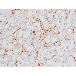 Invitrogen Phospho-Dynamin 1 (Ser774) Polyclonal Antibody 100 &mu;L; Unconjugated:Antibodies,