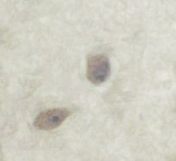 Phospho-PKC zeta (Thr560) Polyclonal Antibody:Antibodies, Polyclonal