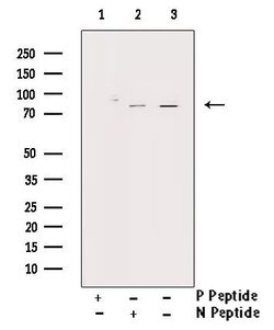 Phospho-PKC zeta (Thr560) Polyclonal Antibody:Antibodies, Polyclonal