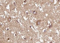 Invitrogen Phospho-NMDAR1 (Ser890) Polyclonal Antibody 100 &mu;L; Unconjugated:Antibodies,