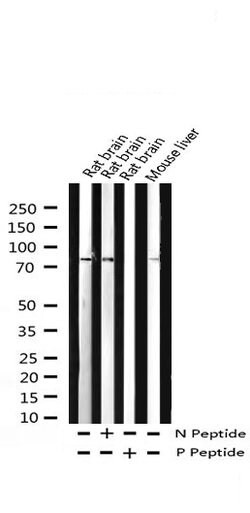 Invitrogen Phospho-PKC delta (Tyr313) Polyclonal Antibody 100 &mu;L; Unconjugated:Antikörper