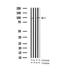 Invitrogen Phospho-PKC delta (Tyr64) Polyclonal Antibody 100 &mu;L; Unconjugated:Antibodies,