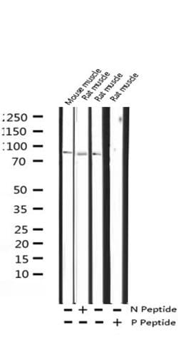 Phospho-Caldesmon (Ser789) Polyclonal Antibody:Antibodies, Polyclonal