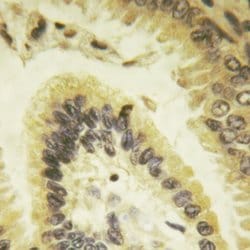 Invitrogen Phospho-Bcl-xL (Thr47) Polyclonal Antibody 100 &mu;L | Buy Online | Invitrogen&trade; | Fisher Scientific