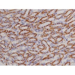 Invitrogen Phospho-Bcl-xL (Thr47) Polyclonal Antibody 100 &mu;L | Buy Online | Invitrogen&trade; | Fisher Scientific
