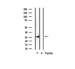 Invitrogen Phospho-Bcl-xL (Thr47) Polyclonal Antibody 100 &mu;L | Buy Online | Invitrogen&trade; | Fisher Scientific