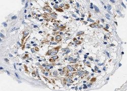 Invitrogen Phospho-BCL-XL (Ser62) Polyclonal Antibody 100 &mu;L; Unconjugated:Antibodies,