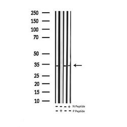 Invitrogen Phospho-BCL-XL (Ser62) Polyclonal Antibody 100 &mu;L; Unconjugated:Antibodies,