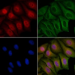 Invitrogen Phospho-FOXO1 (Ser329) Polyclonal Antibody 100 &mu;L; Unconjugated:Antibodies,