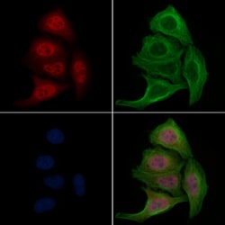 Invitrogen Phospho-FOXO1 (Ser329) Polyclonal Antibody 100 &mu;L; Unconjugated:Antibodies,