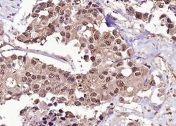 Invitrogen Phospho-FOXO1 (Ser256) Polyclonal Antibody 100 &mu;L; Unconjugated:Antibodies,