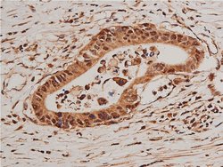 Invitrogen Phospho-FOXO1 (Ser319) Polyclonal Antibody 100 &mu;L; Unconjugated:Antibodies,