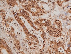 Invitrogen Phospho-FOXO1 (Ser319) Polyclonal Antibody 100 &mu;L; Unconjugated:Antibodies,