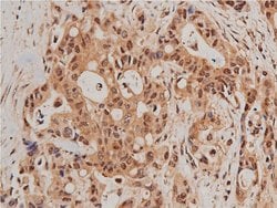 Invitrogen Phospho-FOXO1 (Ser319) Polyclonal Antibody 100 &mu;L; Unconjugated:Antibodies,
