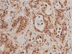 Invitrogen Phospho-FOXO1 (Ser319) Polyclonal Antibody 100 &mu;L; Unconjugated:Antibodies,