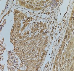 Invitrogen Phospho-FOXO1 (Ser319) Polyclonal Antibody 100 &mu;L; Unconjugated:Antibodies,