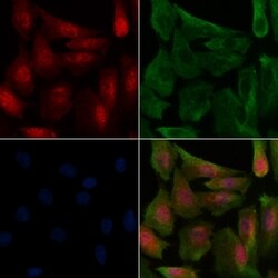 Invitrogen Phospho-FOXO1/FOXO3/FOXO4 (Thr24, Thr32) Polyclonal Antibody