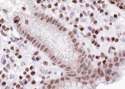 Invitrogen Phospho-FOXO1/FOXO3/FOXO4 (Thr24, Thr32) Polyclonal Antibody