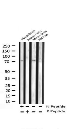 Invitrogen Phospho-FOXO1/FOXO3/FOXO4 (Thr24, Thr32) Polyclonal Antibody