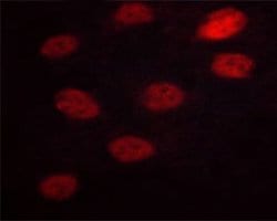 Invitrogen Phospho-NFATC3 (Ser165) Polyclonal Antibody 100 &mu;L; Unconjugated:Antibodies,