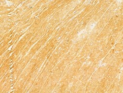 Phospho-Acetyl-CoA Carboxylase (Ser80) Polyclonal Antibody, Invitrogen