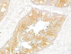 Phospho-Acetyl-CoA Carboxylase (Ser80) Polyclonal Antibody, Invitrogen