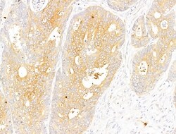 Phospho-Acetyl-CoA Carboxylase (Ser80) Polyclonal Antibody, Invitrogen